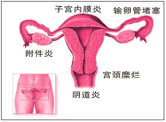 赤峰正规的妇科医院